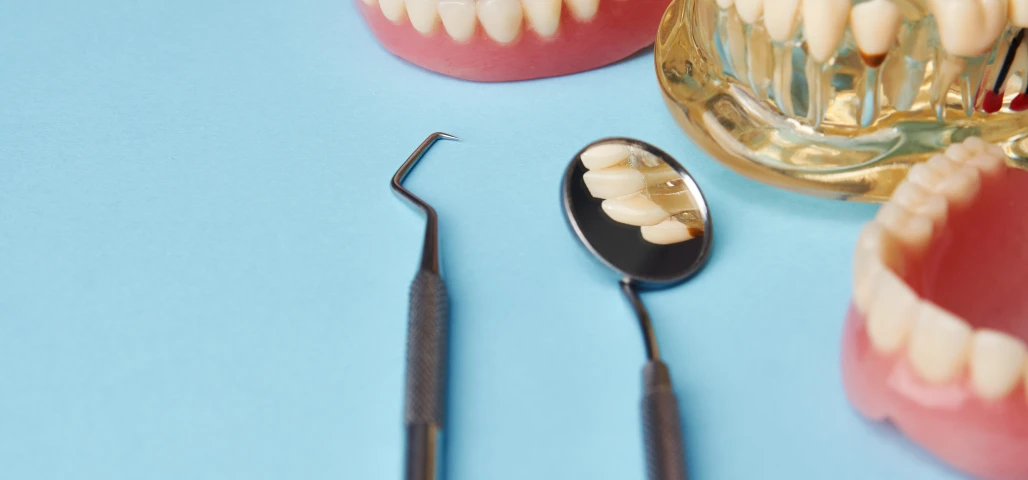 Chirurgie muco-gingivale 