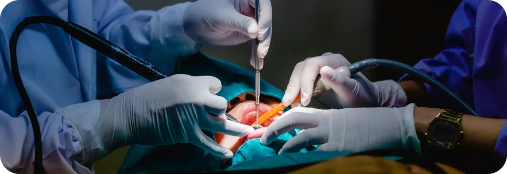 Alignement des collets dentaires  Dr Alexis Duroux, Dentiste à Cannes