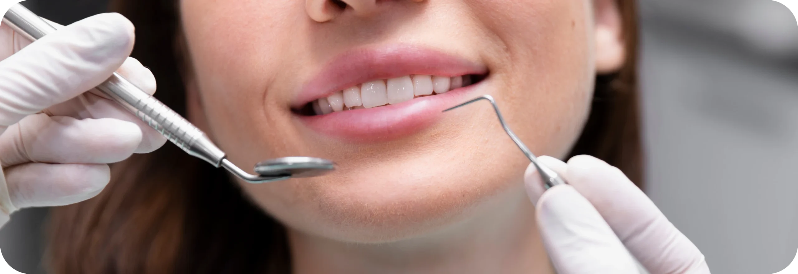 Chirurgie muco-gingivale  Dr Alexis Duroux, Dentiste à Cannes
