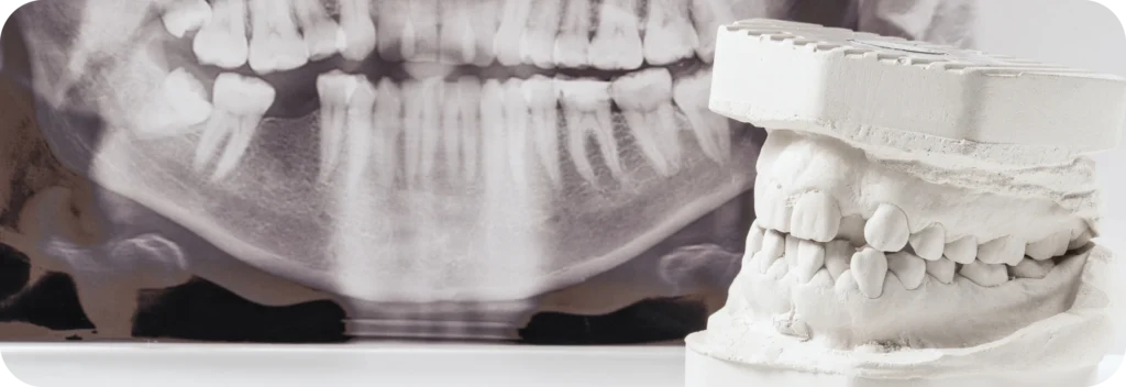 Conseils pré-opératoires Dr Alexis Duroux, Dentiste à Cannes
