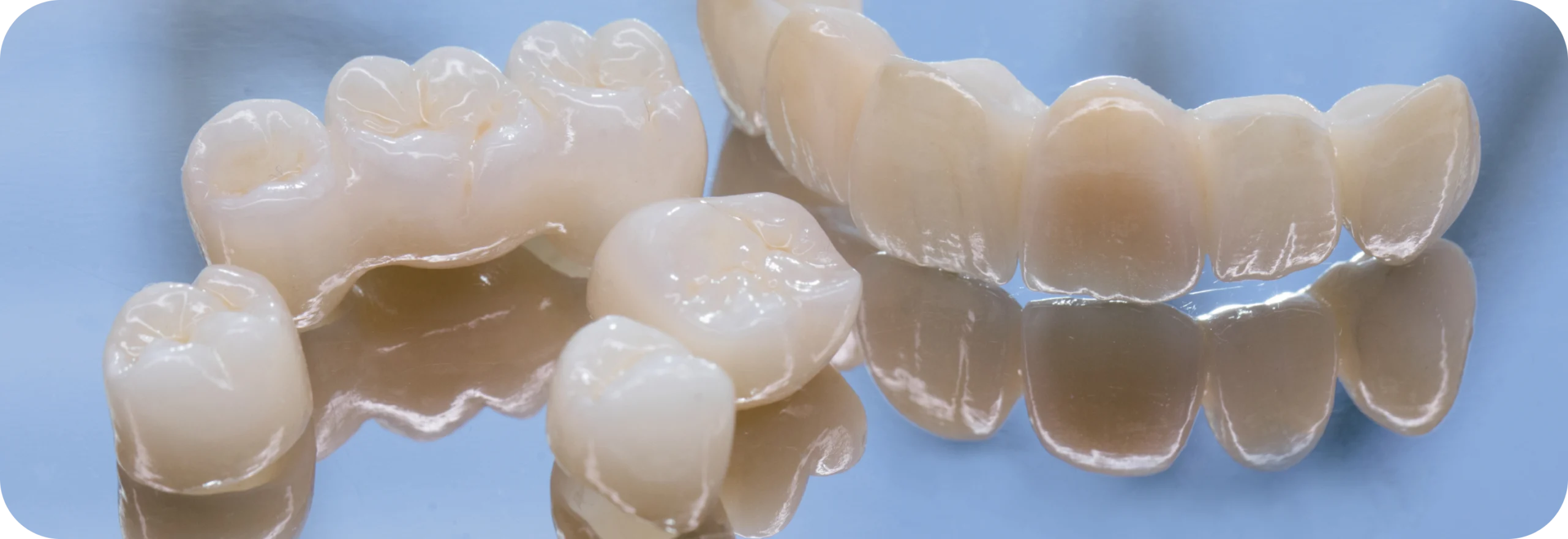 Couronnes céramiques  Dr Alexis Duroux, Dentiste à Cannes