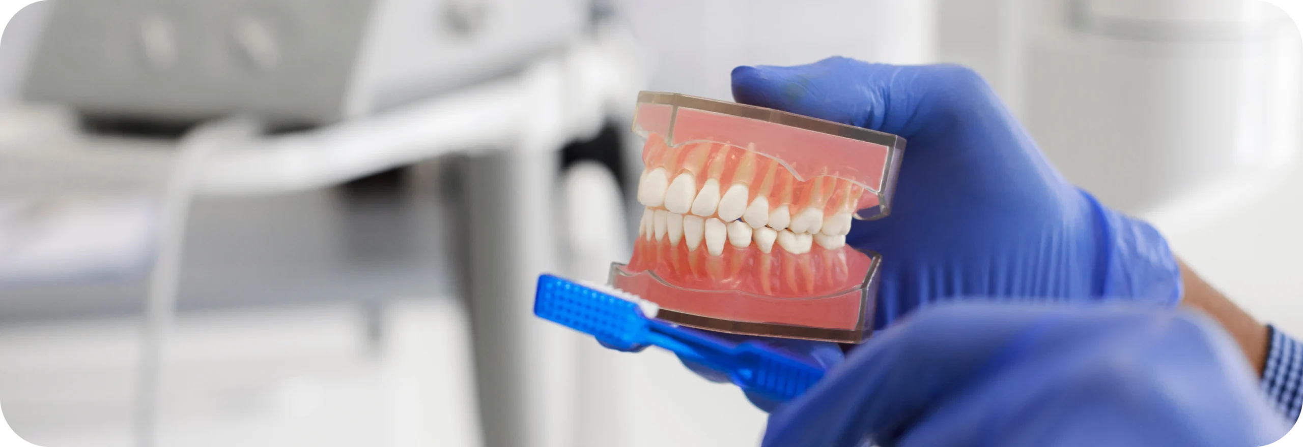 Implant sous-périosté  Dr Alexis Duroux, Dentiste à Cannes
