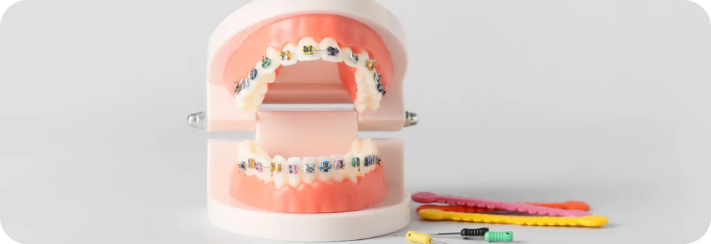 Élastiques Dr Alexis Duroux, Dentiste à Cannes