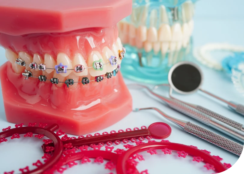Élastiques Dr Alexis Duroux, Dentiste à Cannes
