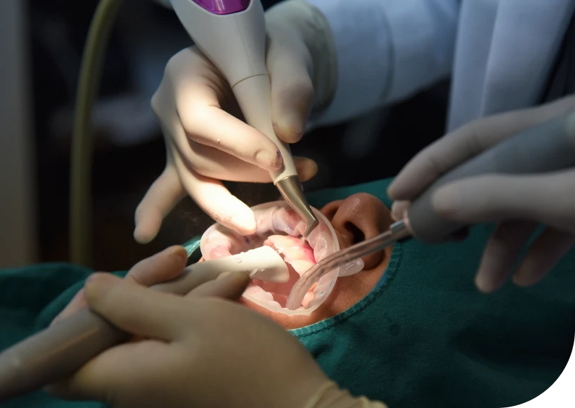 Traitement des gencives  Dr Alexis Duroux, Dentiste à Cannes