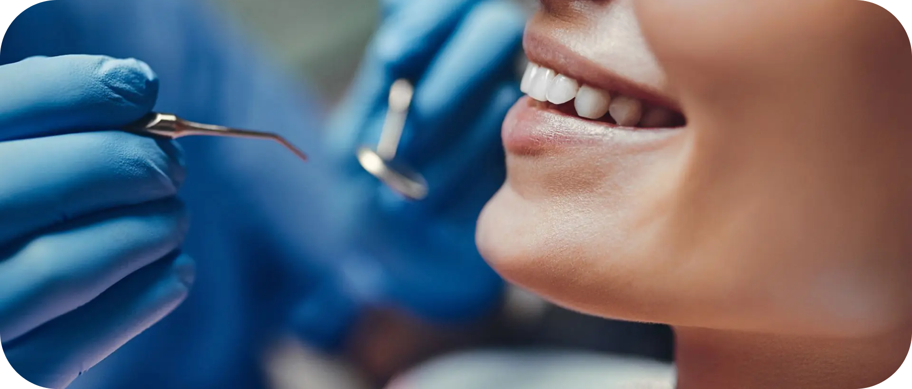 Extractions de dents incluses  Dr Alexis Duroux, Dentiste à Cannes