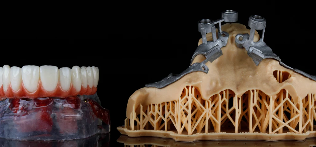 Implant sous-périosté 