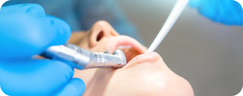 Phobies : ma première visite chez le dentiste Dr Alexis Duroux, Dentiste à Cannes
