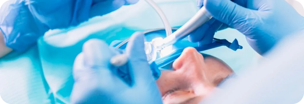 La chirurgie endodontique Dr Alexis Duroux, Dentiste à Cannes