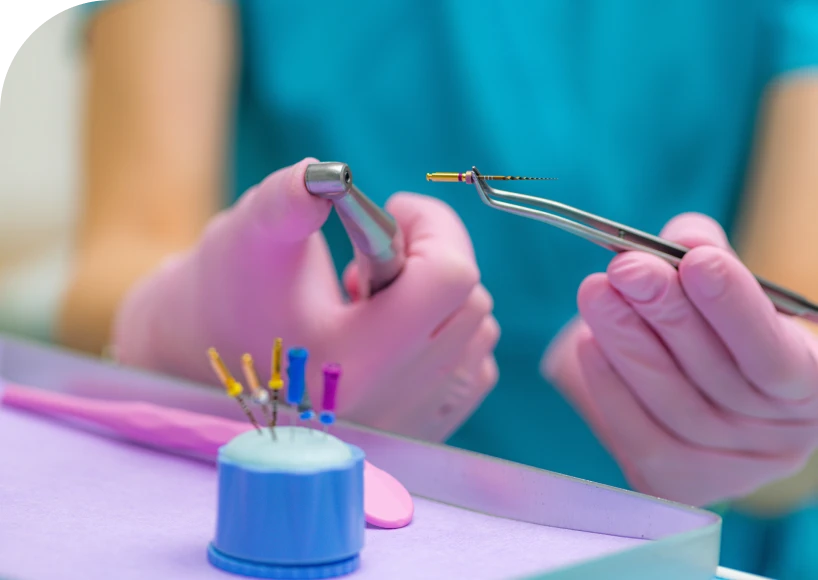 Le retraitement endodontique Dr Alexis Duroux, Dentiste à Cannes